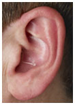 Ottawa Hearing Aids